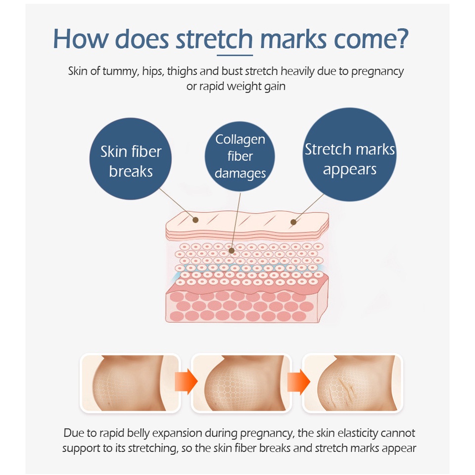 Kem Hỗ Trợ Giảm Sẹo Sau Khi Sinh VIBRANT GLAMOUR Làm Trắng Và Săn Chắc Mịn Mượt Chống Lão Hóa 30g