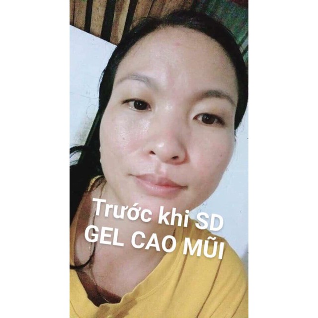 Gel Cao Sống Mũi 🎀 FREESHIP TỪ 450K 🎀Gel cao sóng mũi thảo dược.