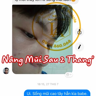 [ HÀNG CAO CẤP ] Tinh chất nâng mũi Pháp Miracle