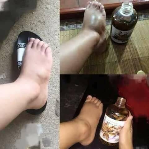 Thảo Dược Xoa Bóp Xương Khớp Người Dao THANH MỘC HƯƠNG 500ml Chính Hãng