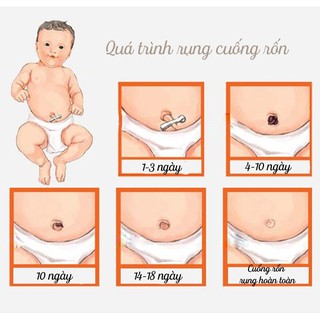 GẠC RỐN SƠ SINH ĐÔNG FA