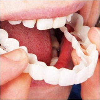 Veneers silicon mềm tạm thời giả trên