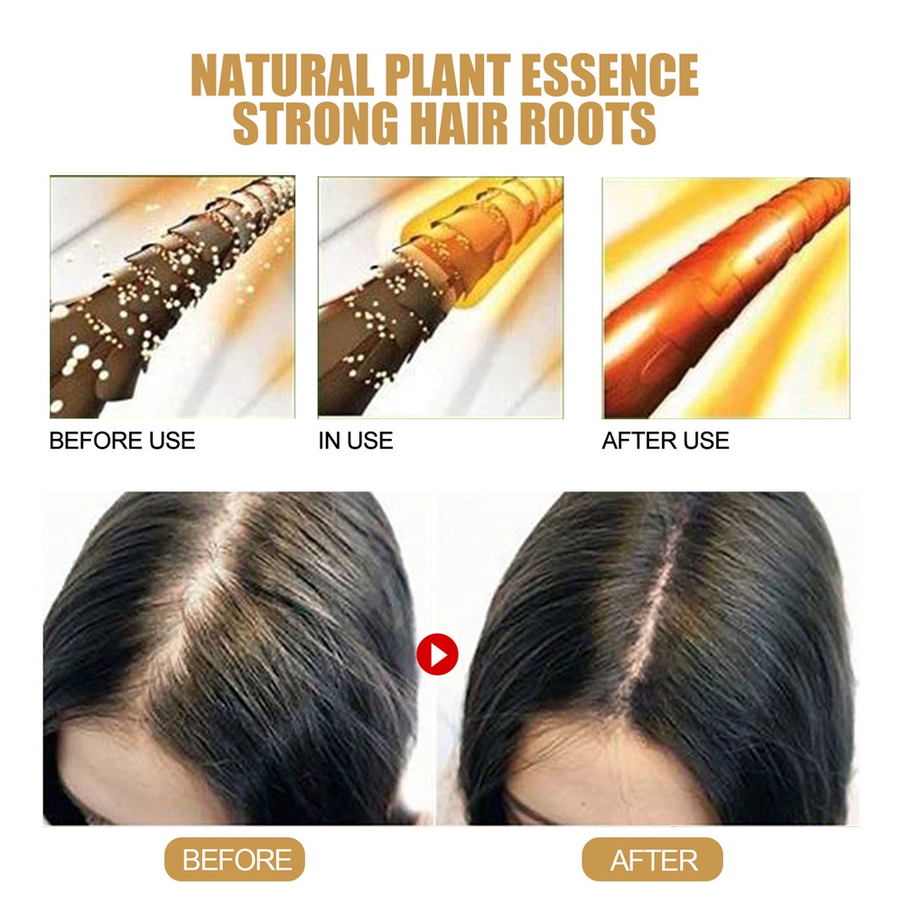 Eelhoe Xà Phòng Dầu Gội Gừng Xà Phòng Dầu Gội Tóc Đen Tóc Loại Bỏ Ve, Kiểm Soát Gàu, Kiểm Soát Dầu, Chống Rụng Và Ngứa-Ampere