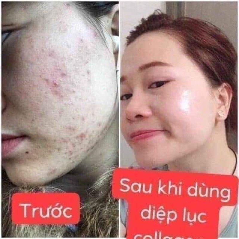 [CHÍNH HÃNG] Diệp Lục Collagen , nước  uống  đẹp  da, mờ nám, mụn, cân bằng  nội tiết tố( có quà tặng kèm)