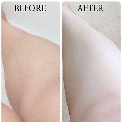 Kem Tẩy Lông Cho Da Thường Cleo Avocado Hair Removal Cream Normal Skin