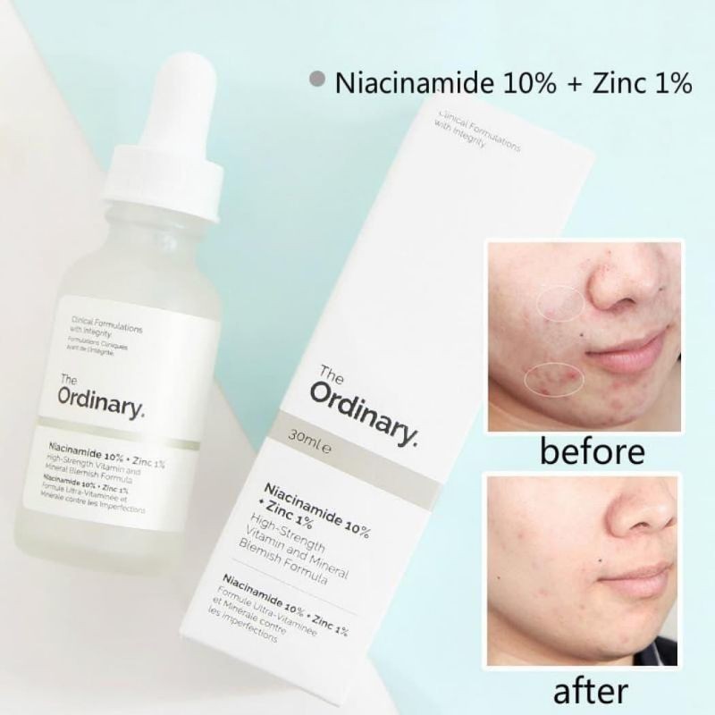Tinh chất giảm mụn, sáng da The Ordinary Niacinamide 10% + Zinc 1%
