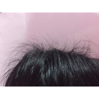 Dầu gội trị gàu, nấm, rụng, kích thích mọc tóc