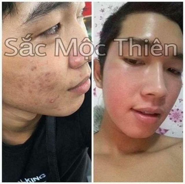 Combo Sắc mộc thiên hàng chính hãng (giá sale)