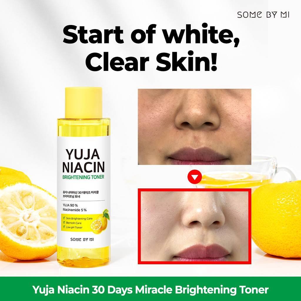 Nước Hoa Hồng Some By Mi Yuja Niacin Brightening Toner 150ml nước hoa hồng hàn quốc