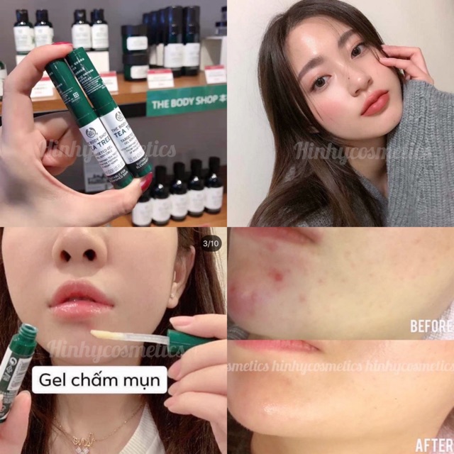 Gel Chấm Mụn Thâm The Body Shop Tea Tree