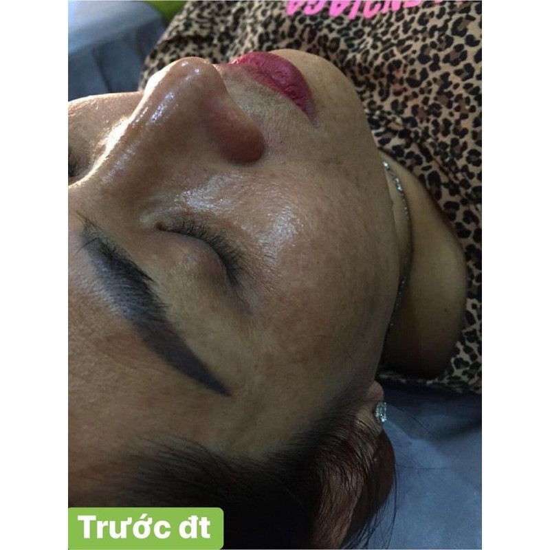 1 HỘP KEM KONE THÁI LAN CHÍNH HÃNG | BigBuy360 - bigbuy360.vn