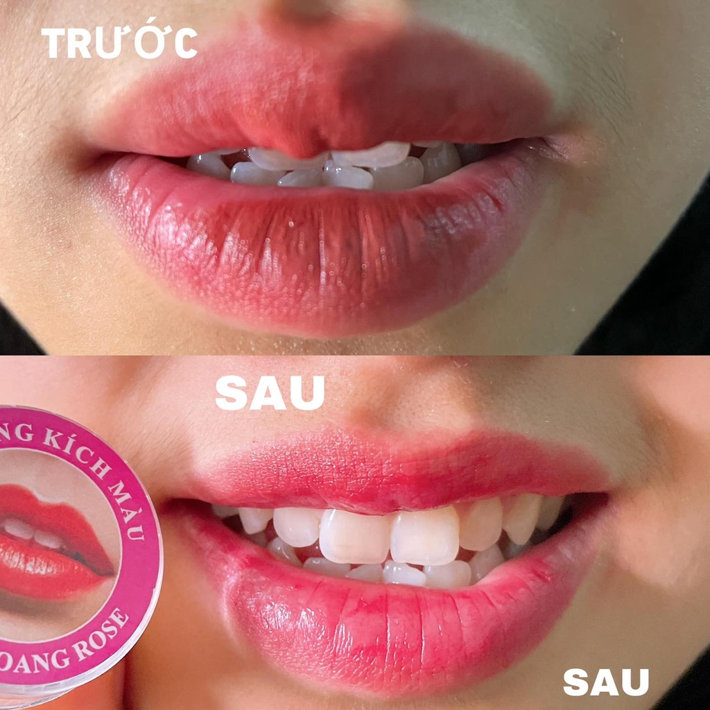 DƯỠNG KÍCH MÀU THÂM LOANG ROSE DÙNG SAU PHUN XĂM
