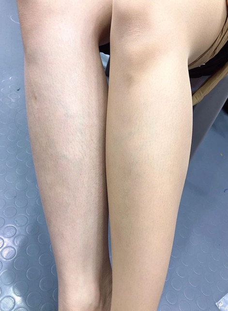 ( Đủ 3 màu) Quần tất thon chân- siêu bền- chống rút sợi- SABRINA Natural fit Made in japan