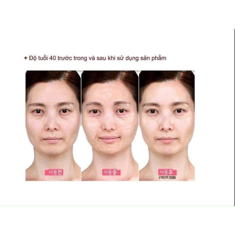 Gel Nâng Cơ Xóa Nhăn CareCella Facial line up lifting gel 1 hộp/4 gói x 9ml, tuyển sỉ, CTV IB