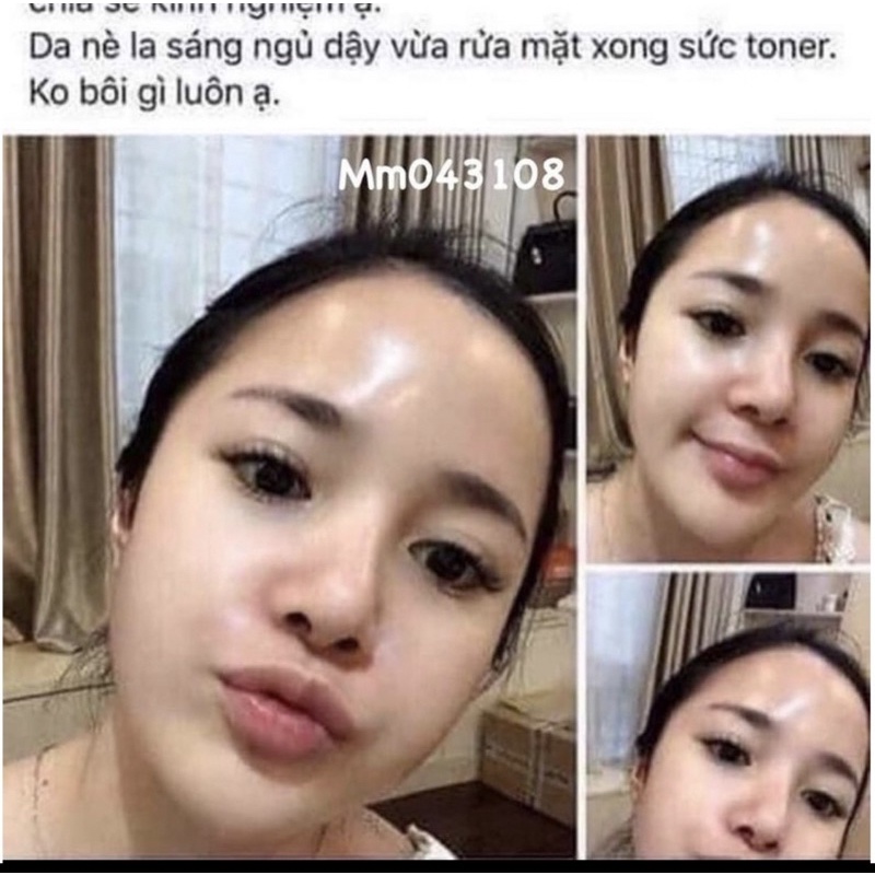 Toner lancome   125ml , Toner cho da nhạy cảm se khít lỗ chân lông