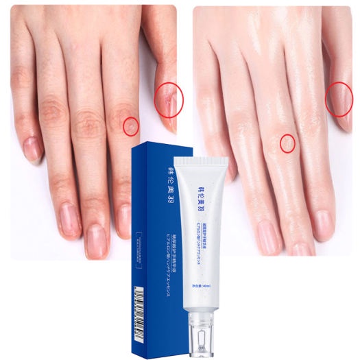 Kem Dưỡng Da Tay EHMZNV Dưỡng Ẩm Chống Nứt Nẻ 40ML