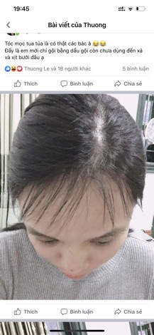 XỊT BƯỞI KÍCH THÍCH MỌC TÓC