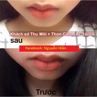 Tinh chất đầy môi, tạo môi trái tim