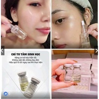 Cấy chỉ tơ tằm Chitossil mờ nhăn, nâng cơ làm đẹp da