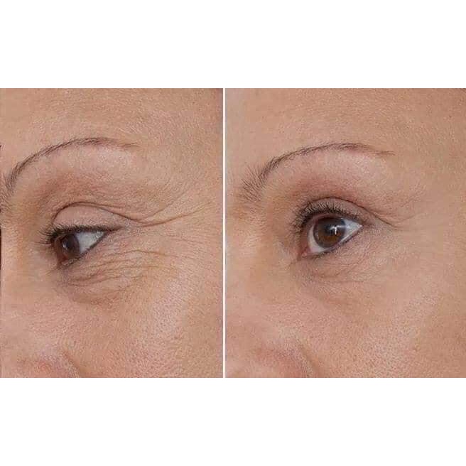 Gói kem mắt OHUI The First Eye Cream