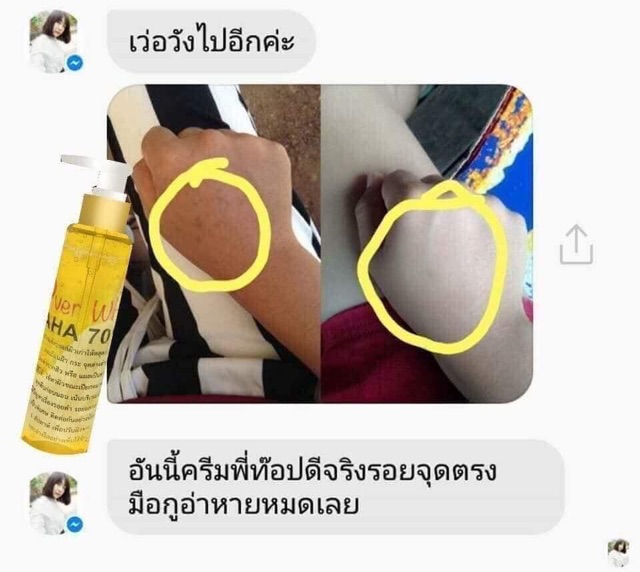 Serum huyết thanh AHA Thái Lan