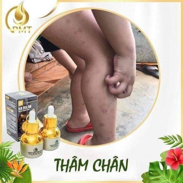 Serum Mờ Thâm Đầu Gối Khuỷu Tay Nách Môi Phúc Minh Tâm - Dưỡng Ẩm Mờ Thâm
