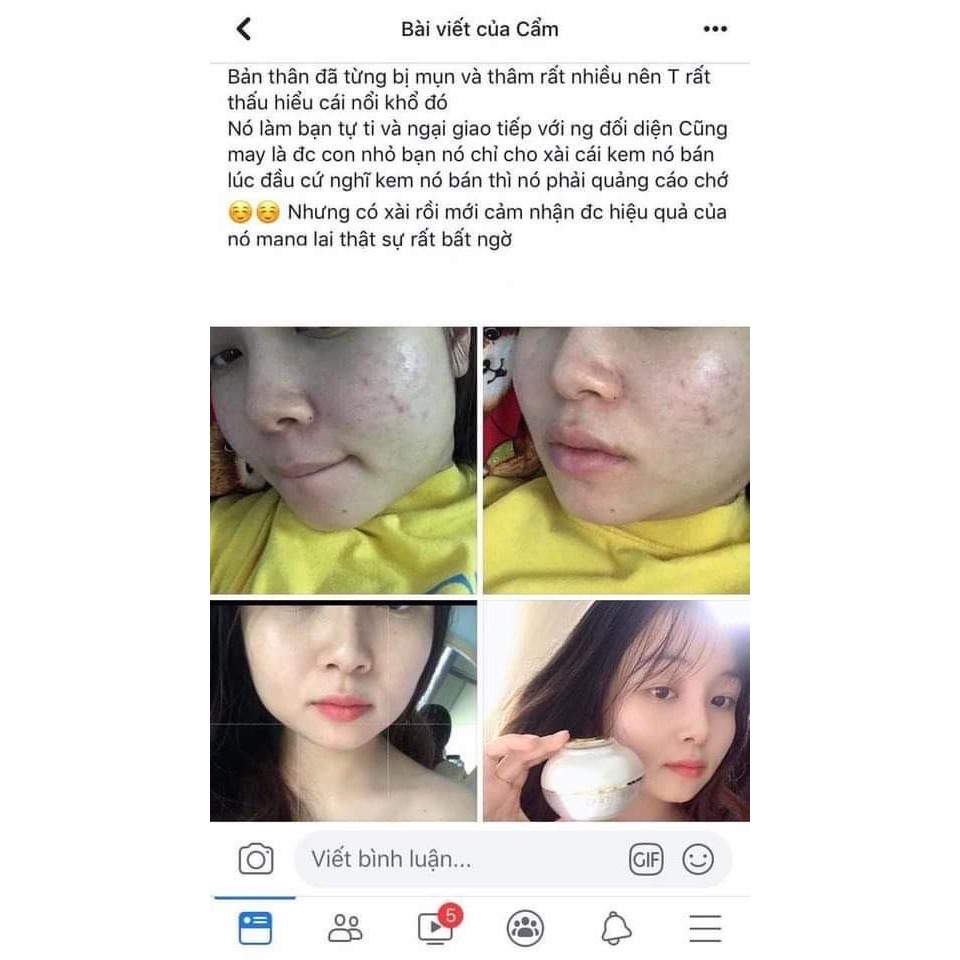 Kem Face Pháp 2020 Acosmetics Phương Anh Chính Hãng - Cải Thiện Mụn - Nám - Tàn Nhang - Cung Cấp Collagen Dưỡng Trắng Da