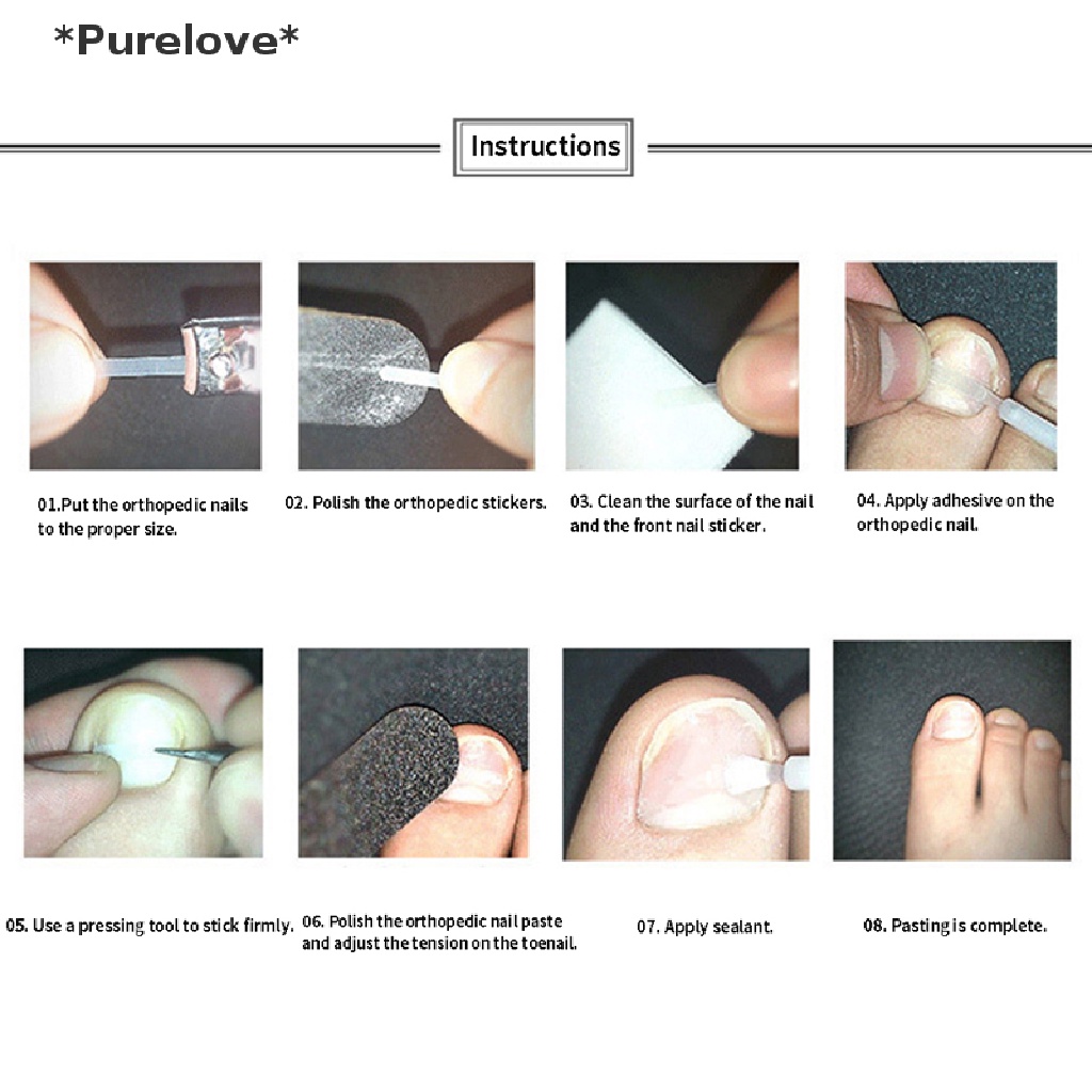 Set 10 Miếng Dán Móng Chân Hỗ Trợ Giảm Bệnh Nấm Móng Tiện Dụng