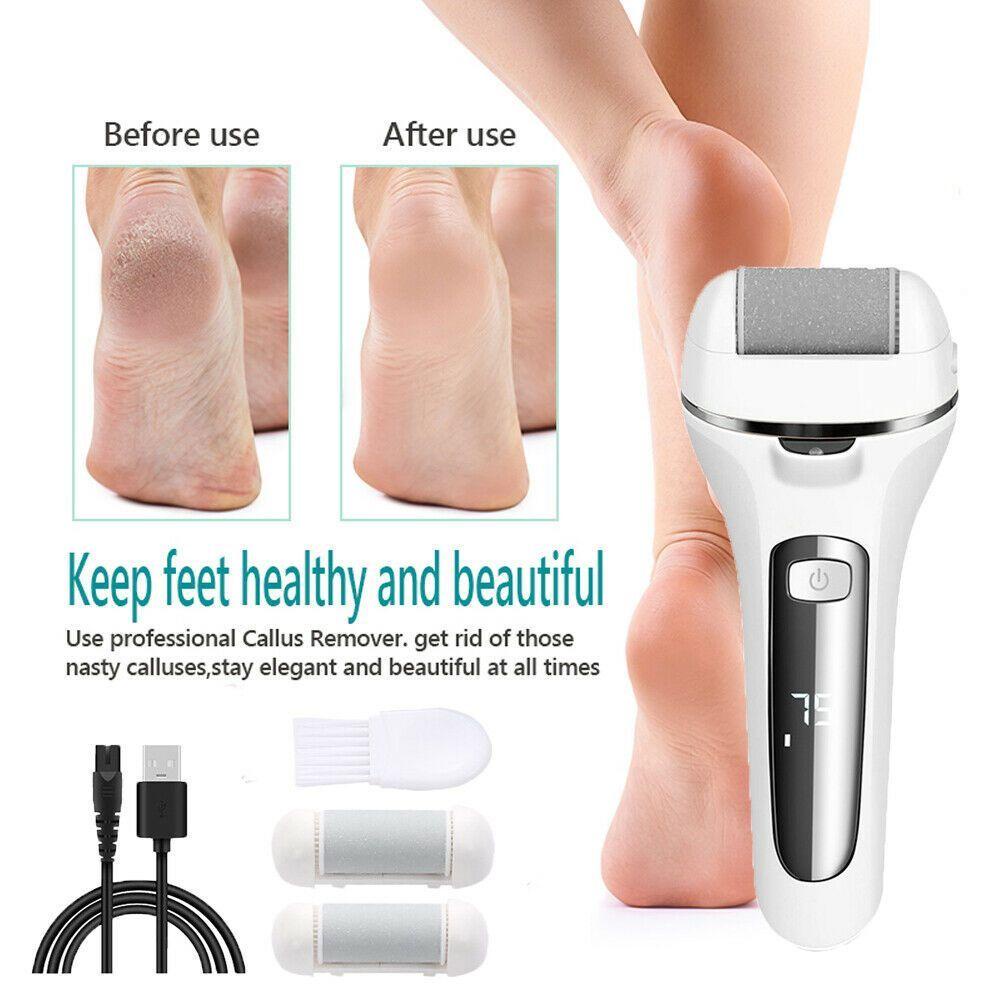 Giấy Nhám Tẩy Tế Bào Chết Cho Bàn Chân Chạy Điện Tiện Dụng