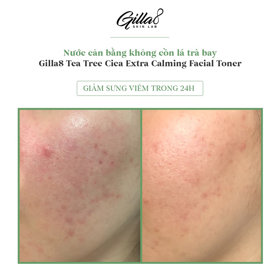 NƯỚC CÂN BẰNG LÁ TRÀ BAY GILLA8 TEA TREE CICA EXTRA CALMING FACIAL TONER | BigBuy360 - bigbuy360.vn