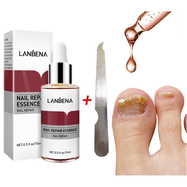 Dung dịch cải thiện nấm móng tay , móng chân Lanbena - tặng kèm 1 cây lấy khóe ( cải thiện rõ rệt sau 1 tháng sử dụng )
