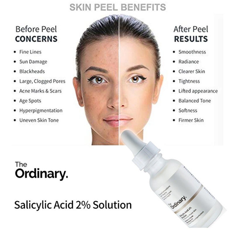 The Ordinary Salicylic acid 2% solution. giải pháp cho các vết thâm mụn hiệu quả nhanh 30ml