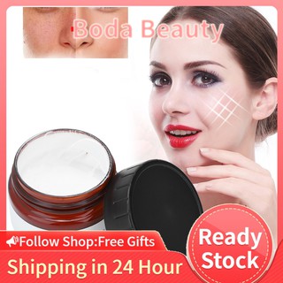 [Wholesale Price] Kem Trị Tàn Nhang Và Vết Cháy Nắng 50g