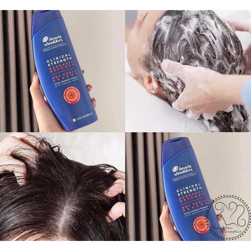 HEAD MỸ GIẢM GÀU, NẤM, DẦU GỘI HEAD & SHOULDERS MỸ CLINICAL STRENGTH 400ML