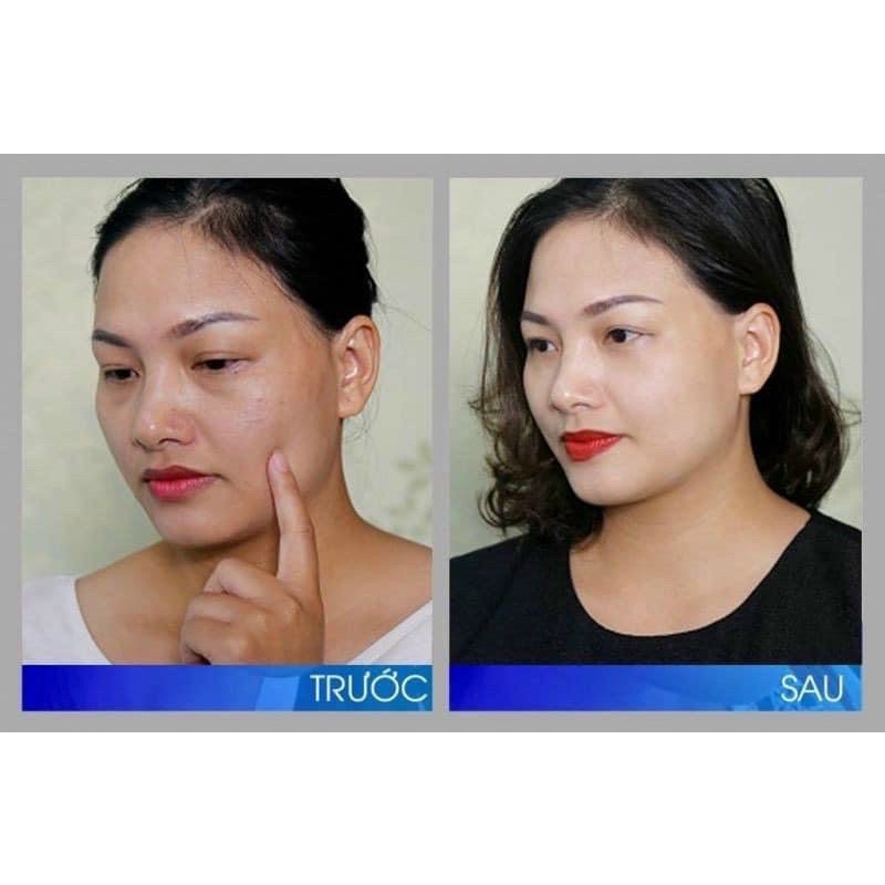 Tuýp 30ml Retinol Repair phục hồi da không gây bong tróc ,tái tạo trẻ hoá da