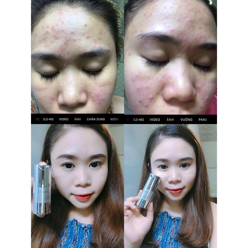 Gel mụn CENLIA 🔥[ CHÍNH HÃNG ]🔥 trả lại làn da sáng mịn sạch mụn, làm mờ thâm mụn, dứt điểm mụn hoàn toàn | BigBuy360 - bigbuy360.vn