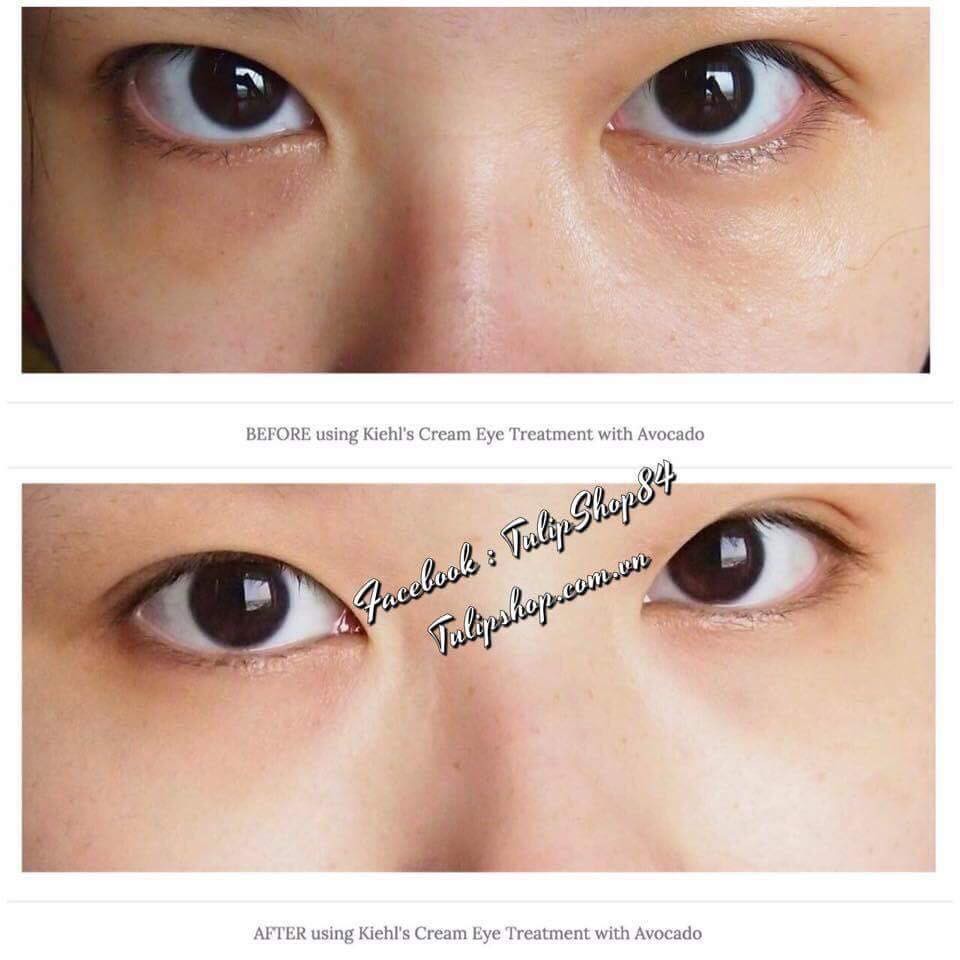 [Có bill] Kem Mắt Kiehl's Creamy Eye Treatment with Avocado | BigBuy360 - bigbuy360.vn