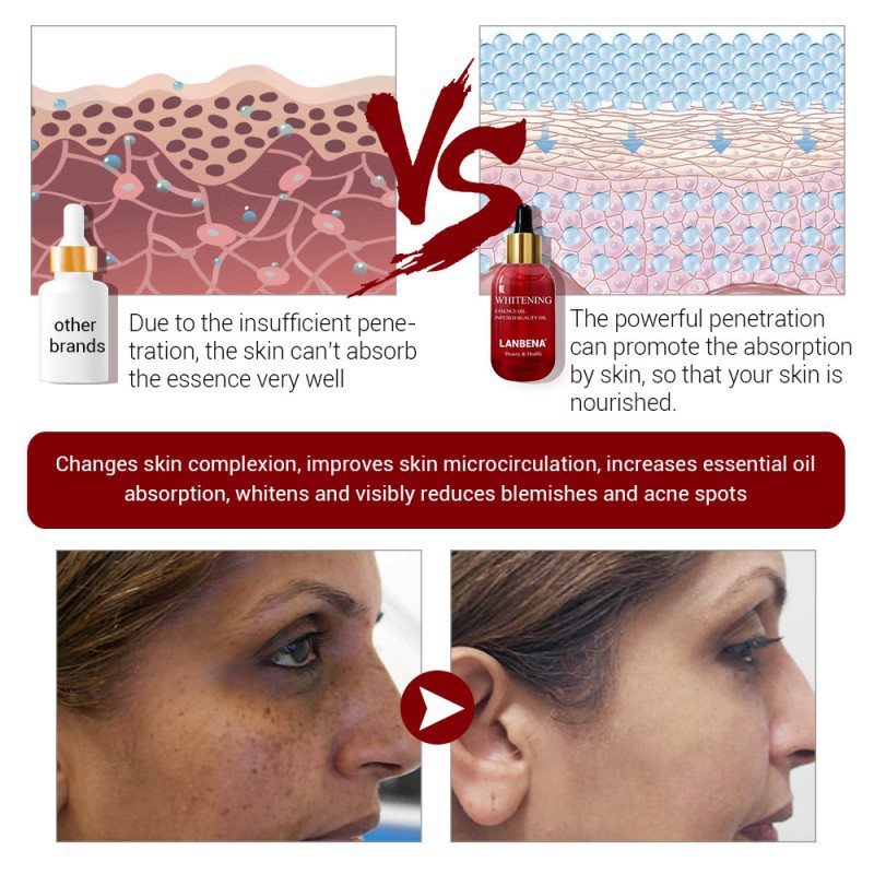Serum LANBENA dưỡng da ngăn ngừa hình thành nếp nhăn và làm chậm lão hóa