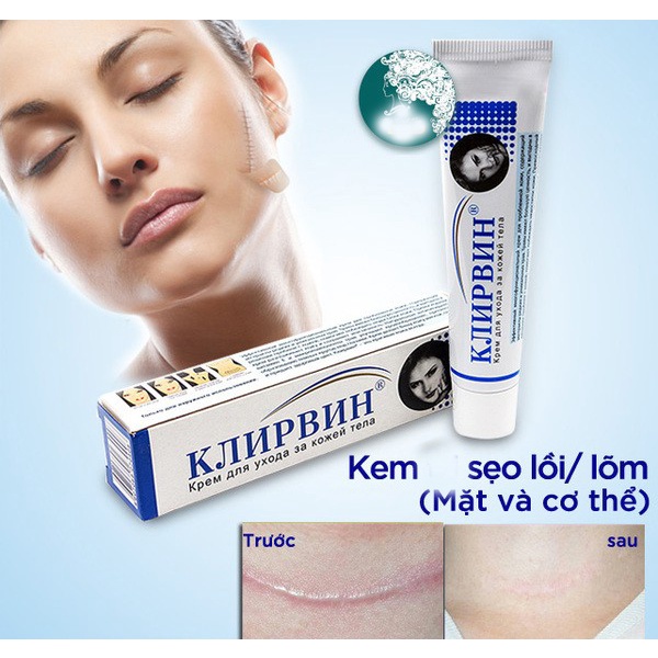 Kem Mờ Sẹo Klirvin Nga - Xoá Mờ Thâm, Sẹo Lồi, Sẹo Lõm Rạn Da - 25g