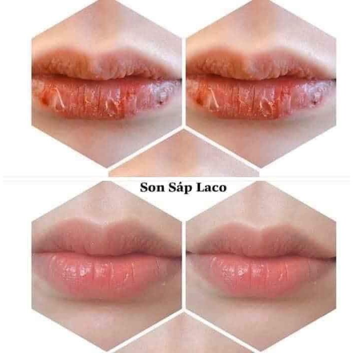 🔥Chính hãng 🔥 Son sáp LACO mờ thâm, dưỡng mềm từ hoa hồng tươi ⚡mờ thâm môi, làm môi hồng mọng tự nhiên cực hiệu quả ⚡ | BigBuy360 - bigbuy360.vn