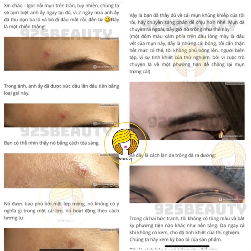 Gel BHA chấm mụn Compliment không chứa cồn giúp giảm mụn hiệu quả | BigBuy360 - bigbuy360.vn