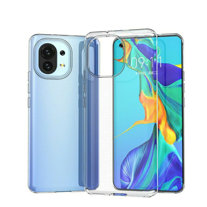 ốp silicon dẻo Xiaomi Mi 10S / mi 11 ultra / redmi 5A
