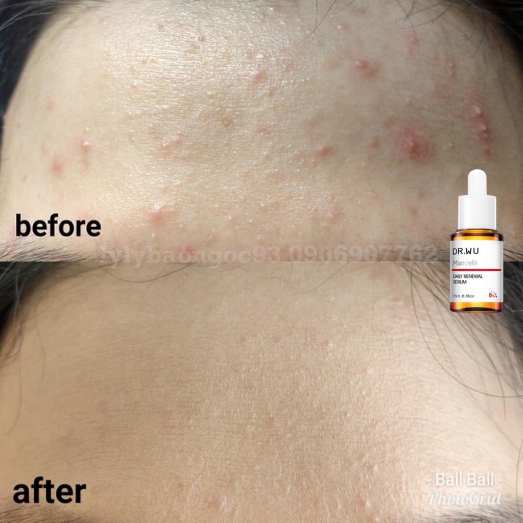 Serum Dr wu Mandelic Acid