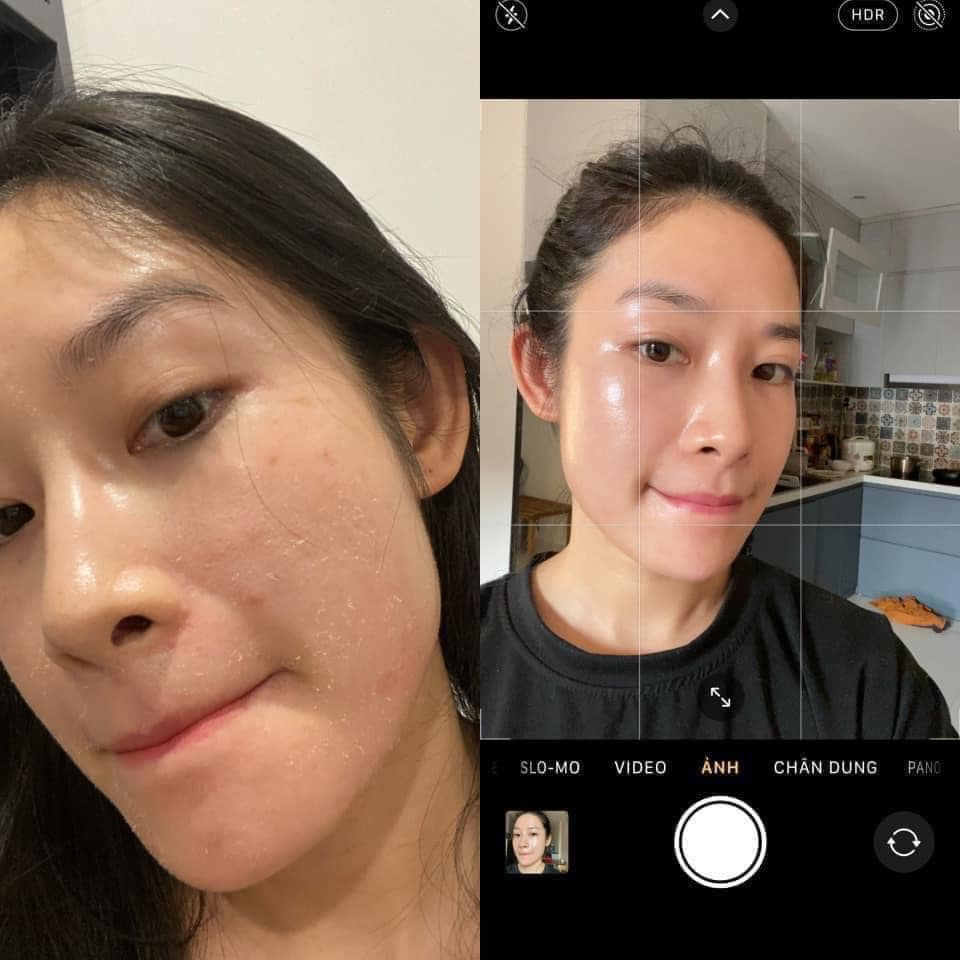 Kem dưỡng chống lão hóa, giảm nếp nhăn, giảm nám, tàn nhang Retinol Skin Brightener 0.25%, 0.5%, 1%