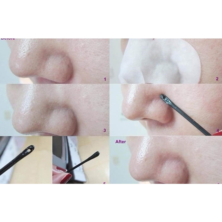 Mặt nạ đẩy mụn đầu đen Ciracle - Miếng Lột Mụn Goodbye Blackhead Cực Kỳ Hiệu Quả