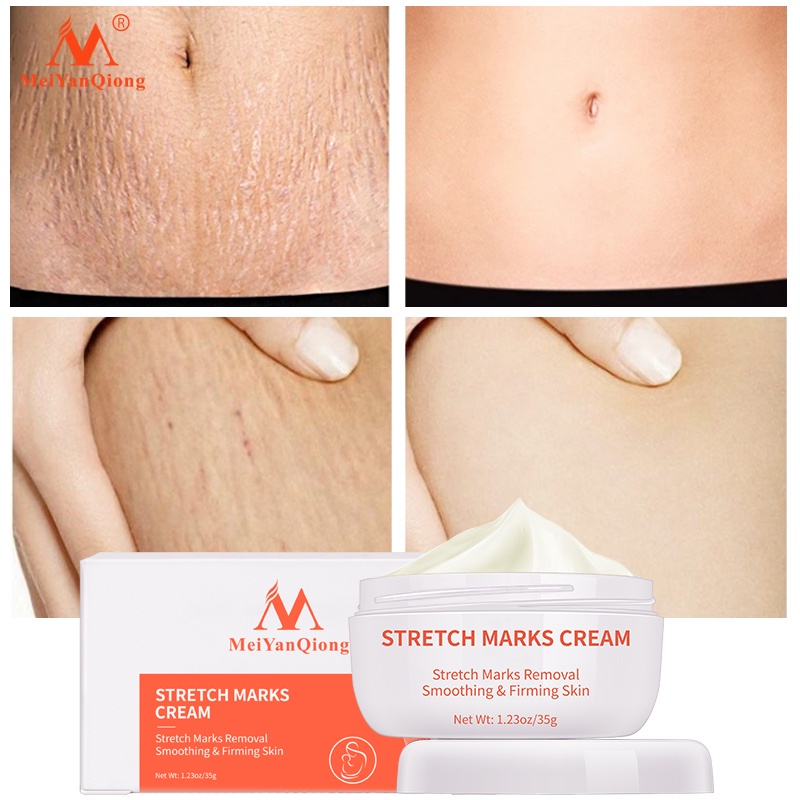 Meiyanqiong Stretch Mark Cream Làm Trắng Và Săn Chắc Mịn Mượt Chống Lão Hóa Giảm rạn da Kem dưỡng ẩm 35g