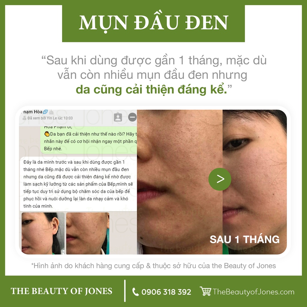 Sample chăm sóc da 4 trong 1 cho da nhạy cảm The Beauty of Jones