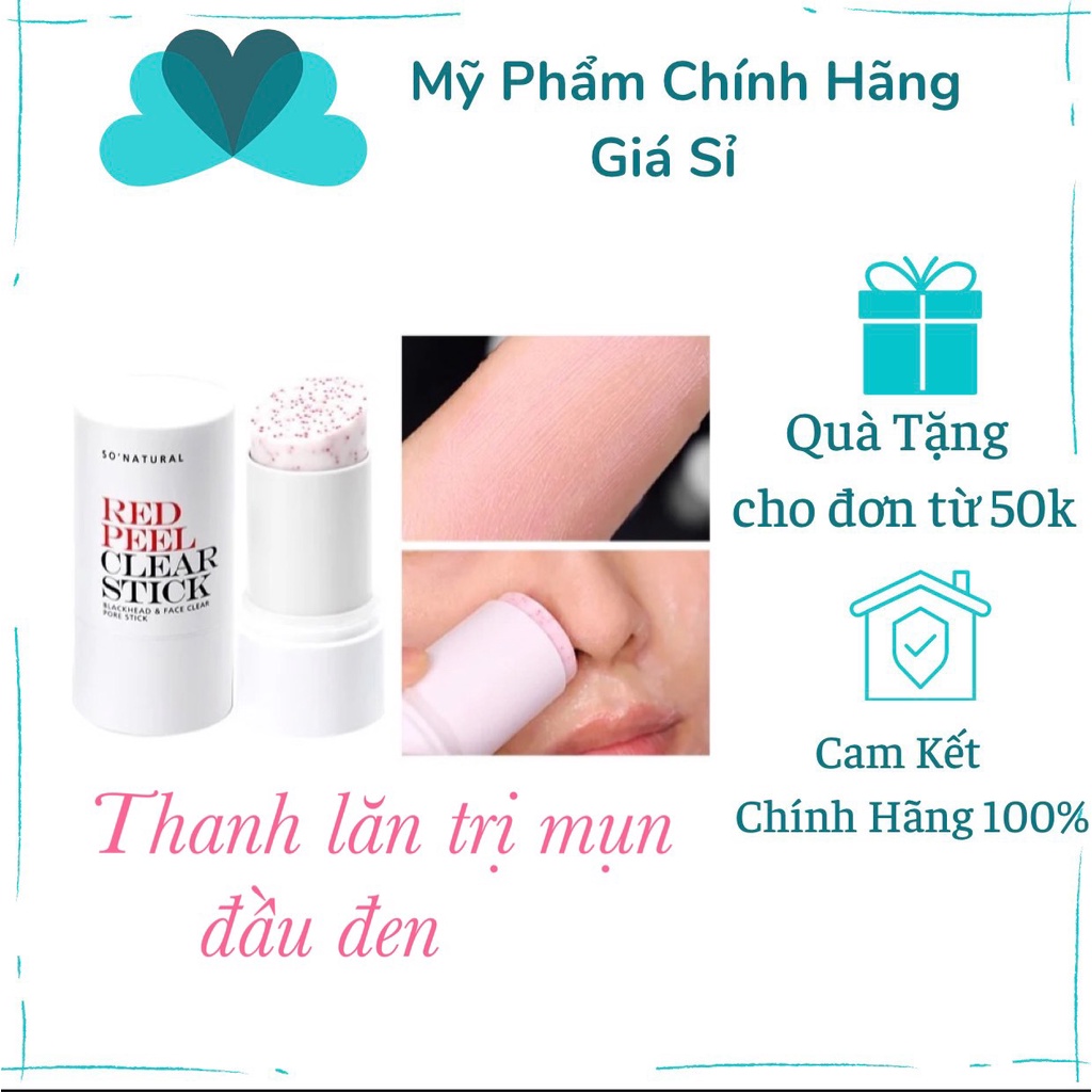 Sáp ngừa mụn So’Natural Red Peel Clear Stick Pore Blackhead &amp; Face 23g