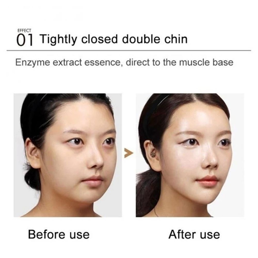 Kem làm thon gọn mặt tạo cằm chữ V chống nếp nhăn săn chắc da cho nữ 30ml