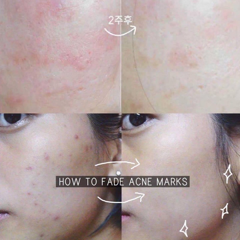 SERUM VITAMIN C KLAIRS SÁNG DA MỜ THÂM - FRESY JUICED VITAMIN DROP